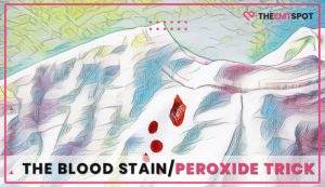 blood stain peroxide trick