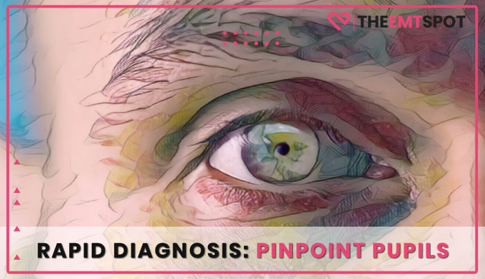 Pinpoint Pupils