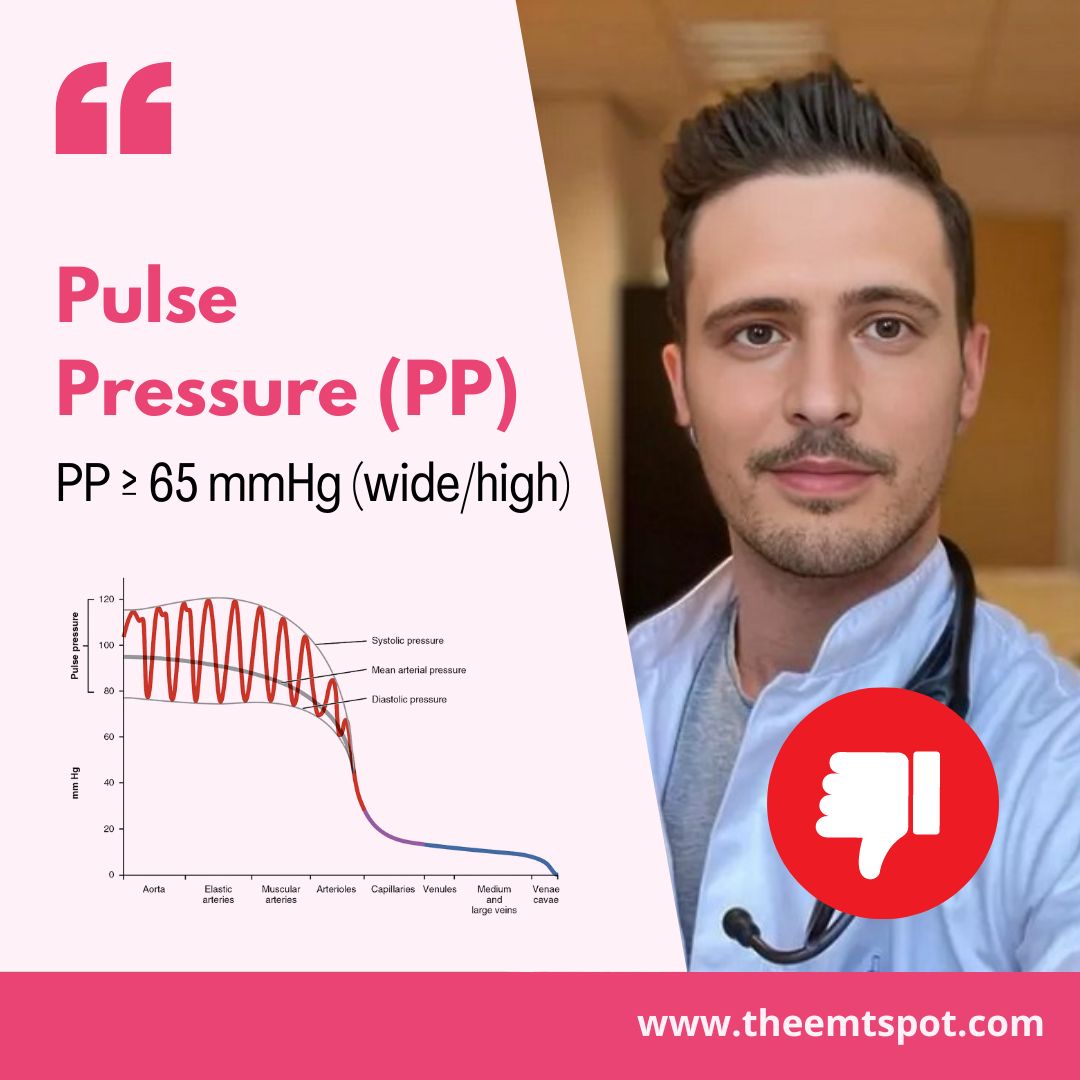 wide pulse pressure